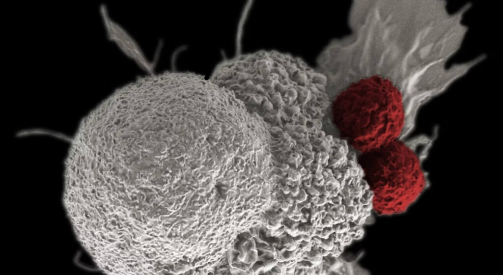 3 Everyday Things That Hold a Cancer Risk and Necessary Precautions